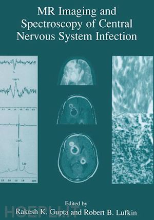 gupta rakesh k. (curatore); lufkin robert b. (curatore) - mr imaging and spectroscopy of central nervous system infection