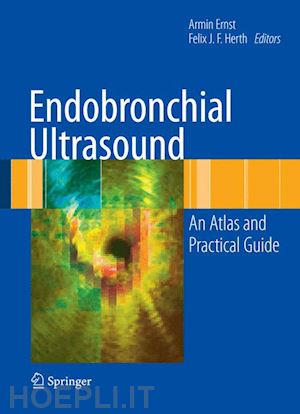 ernst armin (curatore); herth felix jf (curatore) - endobronchial ultrasound