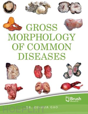 zu-hua gao; yu sshi (coll.); montreal general hospital foundation - gross morphology of common diseases