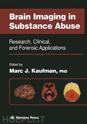 kaufman marc j. (curatore) - brain imaging in substance abuse