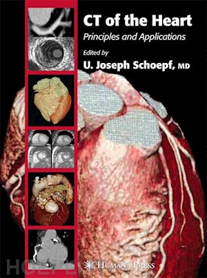 schoepf u. joseph (curatore) - ct of the heart