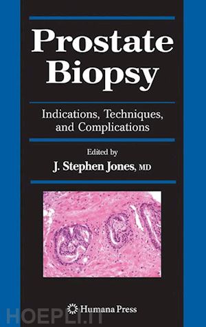 jones j. stephen (curatore) - prostate biopsy