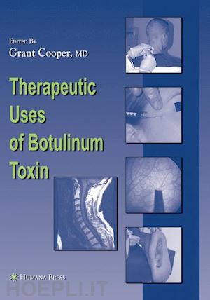 cooper grant (curatore) - therapeutic uses of botulinum toxin