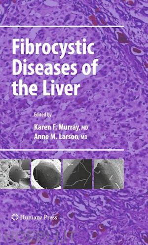murray karen f. (curatore); larson anne m. (curatore) - fibrocystic diseases of the liver
