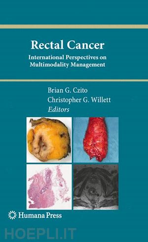 czito brian g. (curatore); willett christopher g. (curatore) - rectal cancer