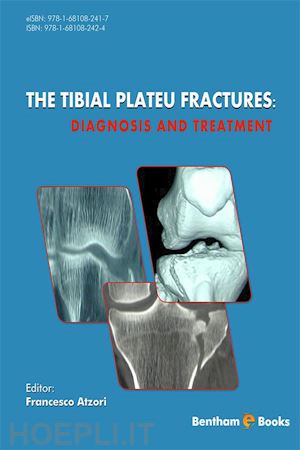 francesco atzori; luigi sabatini - the tibial plateau fractures: diagnosis and treatment