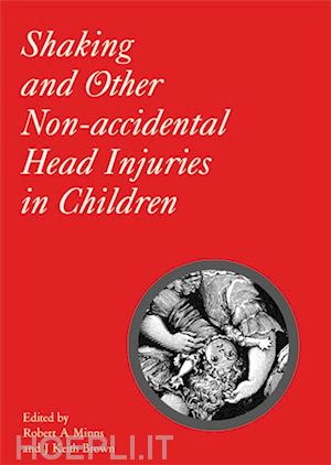 minns ra - shaking and other non-accidental head injuries in children
