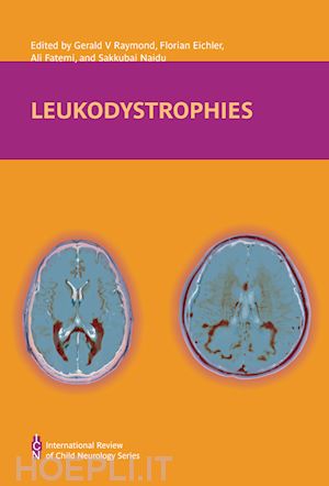 neurology; gerald v. raymond; florian s. eichler - leukodystrophies