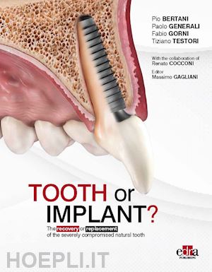 bertani pio, generali paolo, gorni fabio, testori tiziano; gagliani m. (curatore) - tooth or implant?