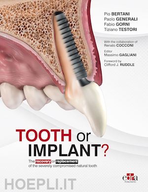 bertani pio; generali paolo; gorni fabio; testori tiziano; gagliani massimo (curatore) - tooth or implant?