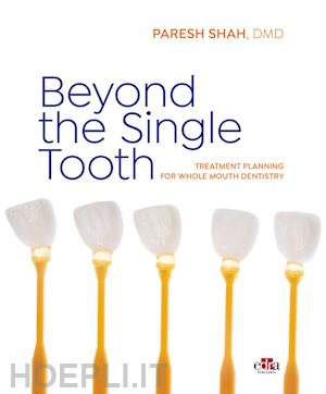 shah paresh - beyond the single tooth. treatment planning for whole mouth dentistry