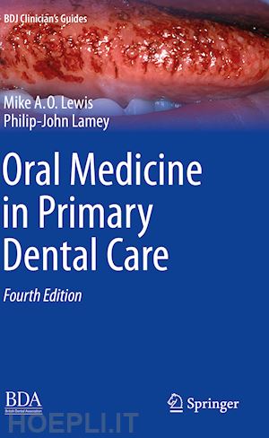 lewis michael a. o.; lamey philip-john - oral medicine in primary dental care