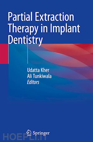 kher udatta (curatore); tunkiwala ali (curatore) - partial extraction therapy in implant dentistry