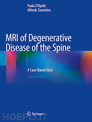 d'aprile paola; tarantino alfredo - mri of degenerative disease of the spine