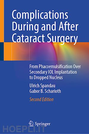 spandau ulrich; scharioth gabor b. - complications during and after cataract surgery