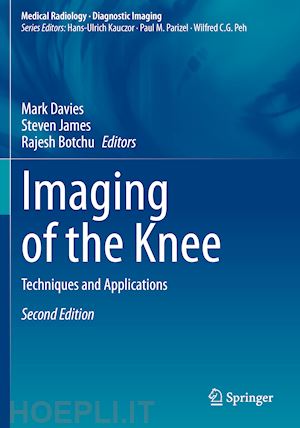 davies mark (curatore); james steven (curatore); botchu rajesh (curatore) - imaging of the knee