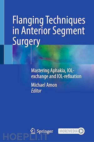 amon michael (curatore) - flanging techniques in anterior segment surgery