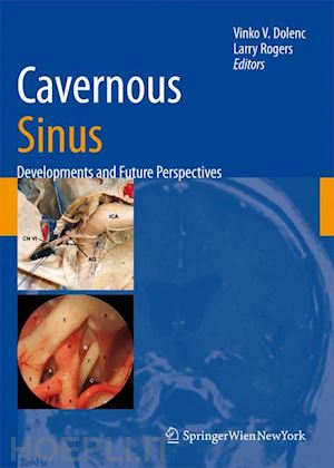 dolenc vinko v. (curatore); rogers larry (curatore) - cavernous sinus