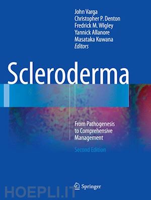 varga john (curatore); denton christopher p. (curatore); wigley fredrick m. (curatore); allanore yannick (curatore); kuwana masataka (curatore) - scleroderma