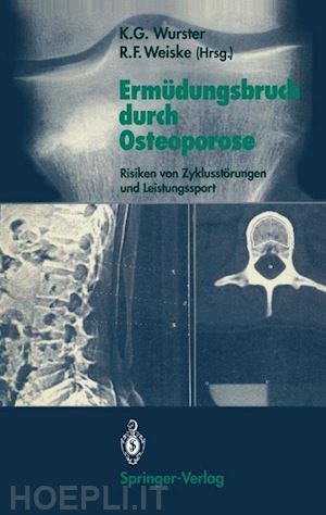 wurster kurt g. (curatore); weiske roman f. (curatore) - ermüdungsbruch durch osteoporose