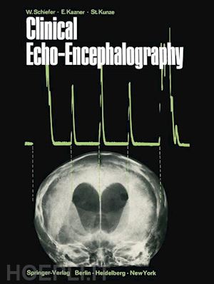 schiefer wolfgang; kazner ekkehard; kunze stefan - clinical echo-encephalography