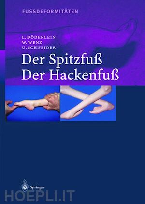 döderlein leonhard; wenz wolfram; schneider urs - fussdeformitäten