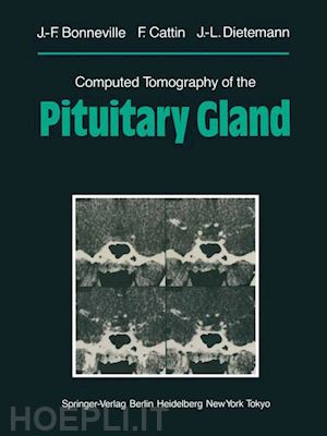 bonneville jean-francois; cattin f.; dietemann jean-louis - computed tomography of the pituitary gland