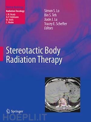 lo simon s. (curatore); teh bin s. (curatore); lu jiade j. (curatore); schefter tracey e. (curatore) - stereotactic body radiation therapy