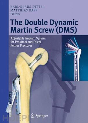 dittel karl-klaus (curatore); rapp matthias (curatore) - the double dynamic martin screw (dms)