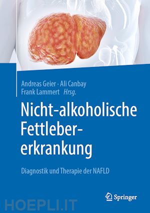 geier andreas (curatore); canbay ali (curatore); lammert frank (curatore) - nicht-alkoholische fettlebererkrankung