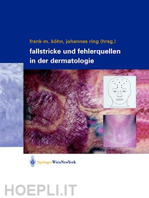 köhn frank-michael (curatore); ring johannes (curatore) - fallstricke und fehlerquellen in der dermatologie