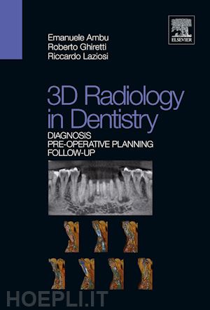 ambu emanuele; ghiretti roberto; laziosi riccardo - 3d radiology in dentistry. diagnosis pre-operative planning follow-up