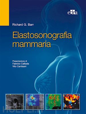 barr richard g.; cantisani v. (curatore); calliada f. (curatore) - elastosonografia mammaria