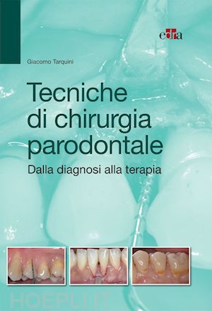 tarquini giacomo - tecniche di chirurgia parodontale