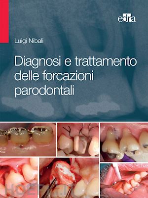nibali  luigi - diagnosi e trattamento delle forcazioni parodontali