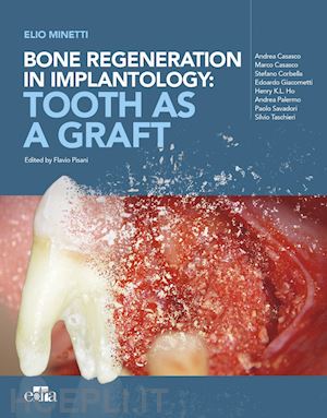 minetti elio - bone regeneration in implantology: tooth as a graft