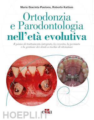 paolone maria giacinta, kaitsas roberto - ortodonzia e parodontologia nell'eta' evolutiva.