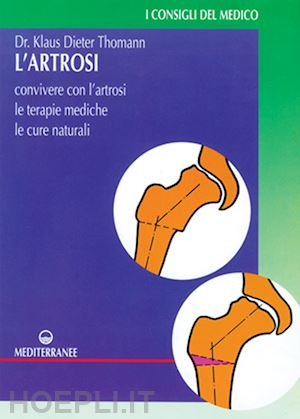 thomann klaus-dieter - artrosi. come convivere con l'artrosi. le terapie mediche, le cure individuali (