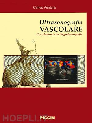 ventura - ultrasonografia vascolare