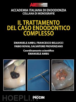 ambu emanuele; bellucci francesco, rovai fabio, provenzano salvatore - il trattamento del caso endodontico complesso