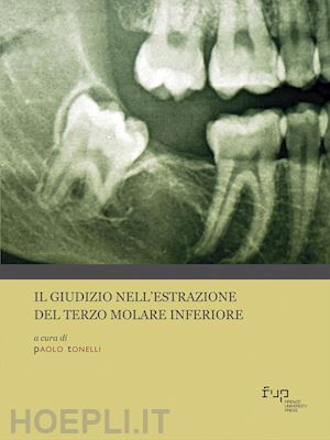 tonelli paolo (curatore) - il giudizio nell'estrazione del terzo molare inferiore