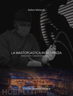 marianelli stefano - la mastoplastica in sicurezza. come evitare e risolvere le complicanze