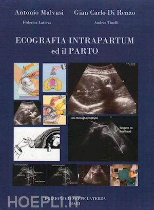  - ecografia intrapartum ed il parto