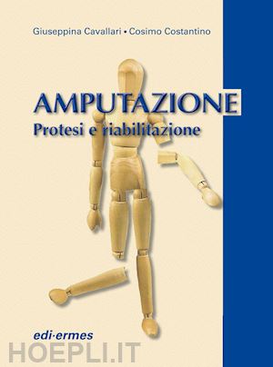 cavallari - amputazione: protesi e riabilitazione