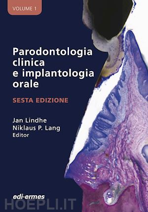 lang n. p. (curatore); lindhe j. (curatore) - parodontologia clinica e implantologia orale