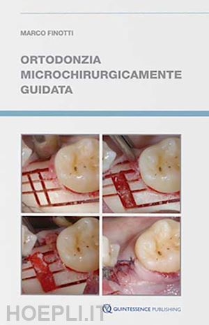 finotti marco - ortodonzia microchirurgicamente guidata