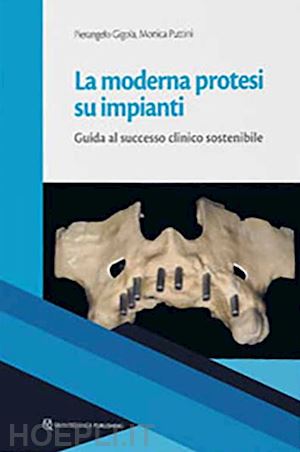 gigola pierangelo; puttini m. (curatore) - la moderna protesi su impianti. guida la successo clinico sostenibile