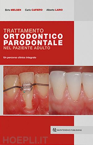 melsen birte; cafiero carlo; laino alberto - trattamento ortodontico parodontale nel paziente adulto. un percorso clinico int