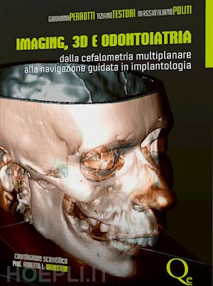 perrotti giovanna; testori tiziano; politi massimiliano - imaging, 3d e odontoiatria. dalla cefalometria multiplanare alla navigazione guidata in implantologia