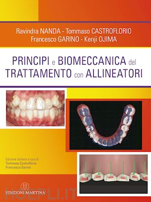 Tecnica Ortodontica con Allineatori - Clinicadrm